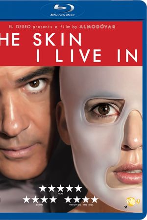 Lớp vảy tôi mang